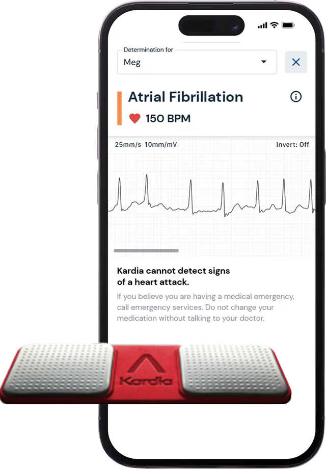 KardiaMobile Personal EKG Device